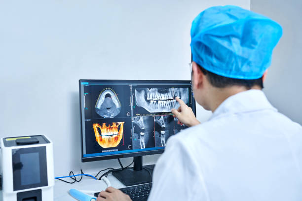 Best Emergency Dental Extractions in Beesleys Point, NJ